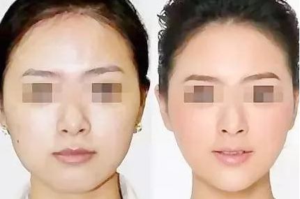 南京華美美容醫(yī)院：值得信賴的專業(yè)醫(yī)生、熱門(mén)項(xiàng)目和滿意口碑