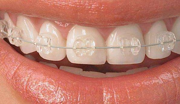 商洛中醫(yī)醫(yī)院燒傷整形科：口碑佳，價(jià)格公道，性價(jià)比高