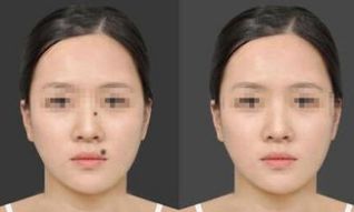 天津疤痕修復(fù)名院盤點(diǎn)：醫(yī)大總院、南開醫(yī)院、美萊位列前茅