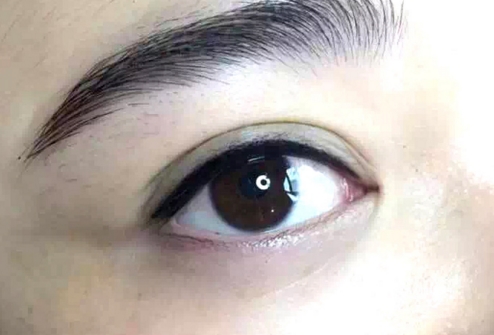 常州百年植發(fā)醫(yī)院的擅長(zhǎng)項(xiàng)目有哪些？錯(cuò)失不再有毛發(fā)煩惱的機(jī)會(huì)了嗎？