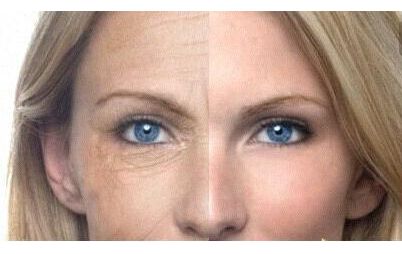 上海華美謝衛(wèi)國醫(yī)生：隆鼻案例驚艷，塑造完美鼻型效果太真實(shí)