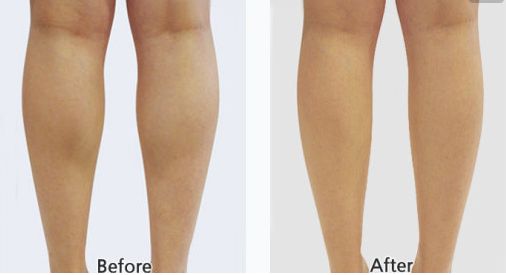 哪家醫(yī)院在武漢做自體脂肪隆胸效果好仁愛時光、藝星、華美等TOP5可選~