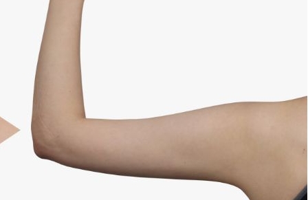 銀川陳勇博士醫(yī)療美容整形醫(yī)院醫(yī)生團隊是否備受認可？他們的案例能夠展現(xiàn)多少成功經(jīng)驗？