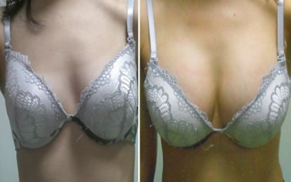 宜昌瑞銘整形醫(yī)院鼻子整形效果如何？有專家推崇！