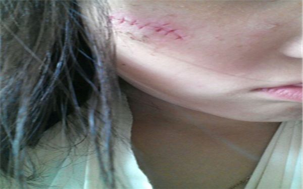 鄭州整形醫(yī)院排行前五！這五家醫(yī)院值得一看！