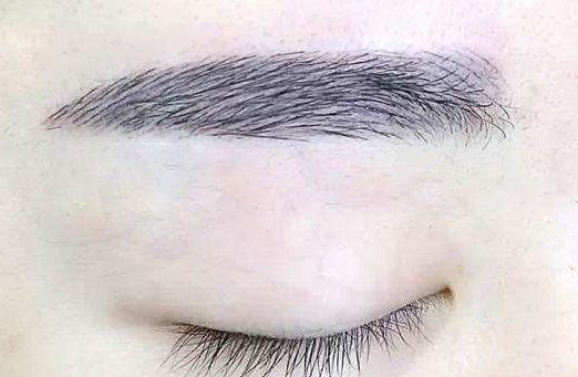 深圳治療疤痕的醫(yī)院推薦！實(shí)時(shí)更新名單發(fā)布！