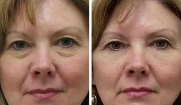 廣州植發(fā)領(lǐng)先機(jī)構(gòu)推薦：連鎖醫(yī)院專業(yè)信譽(yù)備受肯定！