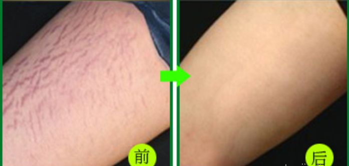 杭州地道整形好醫(yī)院推薦，當(dāng)?shù)鼐用窳λ]的高水平醫(yī)療機構(gòu)