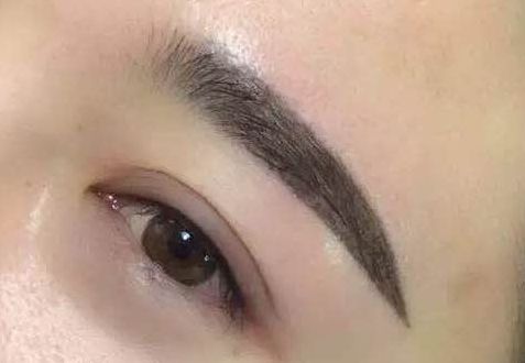 華西卿勇隆鼻技術(shù)體驗(yàn)分享：醫(yī)生實(shí)力評(píng)述及效果圖展示！