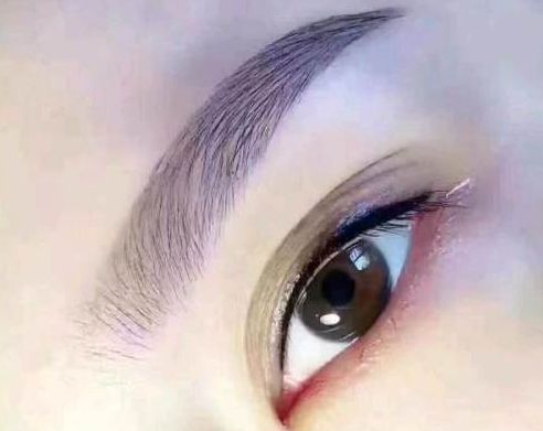 孟慶鵬最新鼻部整形手術(shù)效果怎么樣？贊譽無數(shù)的醫(yī)生評價+手術(shù)案例分享！鄭州uu們必看~