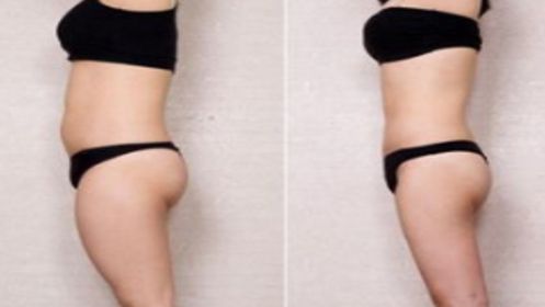 上海有哪些值得推薦的眼部修復醫(yī)院？前五脫穎而出，口碑極佳，讓你放心選擇