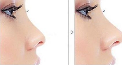 蘭州比較好的乳房整形醫(yī)院排名最新公布！附最新價(jià)格表，必收！