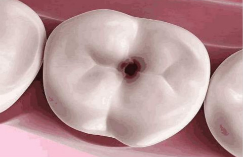 滄州有哪些醫(yī)院可以信賴進(jìn)行開(kāi)眼角手術(shù)？如何選擇更適合自己的醫(yī)院？