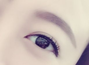 劉春軍豐胸手術(shù)后效果如何？費(fèi)用怎么樣？醫(yī)生概況+隆胸真實(shí)案例圖為參考