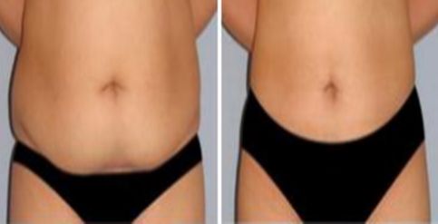 深圳2023年最有口碑的面部填充醫(yī)生推薦！快來(lái)看看他們的簡(jiǎn)介！