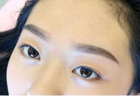 最佳選擇！濟(jì)南眼部整形資深專家Top10名單揭曉