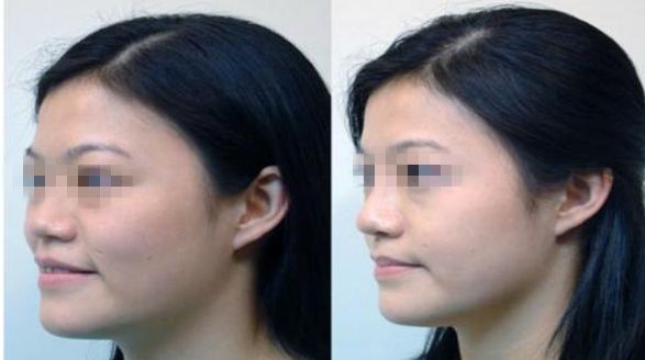 濟(jì)南市哪家整形醫(yī)院正規(guī)專業(yè)？推薦可靠的名單