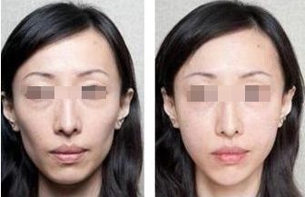 北京頂尖整形醫(yī)院排行榜公布，這三家實(shí)力過硬