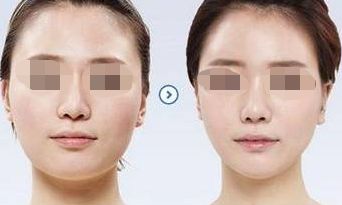 青島2024年最受歡迎的整容醫(yī)院排名榜