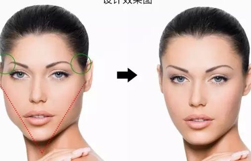 北京吸脂手術(shù)醫(yī)院排行榜2024更新，專家推薦+用戶口碑評價(jià)