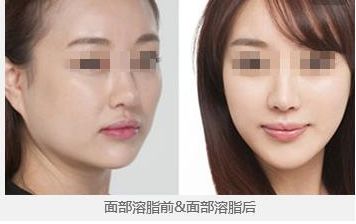 2024年昆明哪家整形醫(yī)院更受歡迎？你一定不知道！