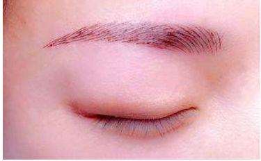 深圳醫(yī)生劉冰的鼻子整形效果如何？專業(yè)實力及成功案例發(fā)布