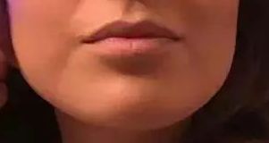 2023北京八大處醫(yī)院雙眼皮手術(shù)醫(yī)生榜單揭曉，楊明勇、王佳琦、靳小雷等醫(yī)師備受好評(píng)！