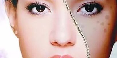 上海眼部修復(fù)專家推薦，治療眼部問題可信賴！