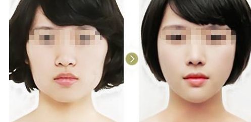 廈門哪家醫(yī)美醫(yī)院口碑最好？專業(yè)特色診療機(jī)構(gòu)一覽