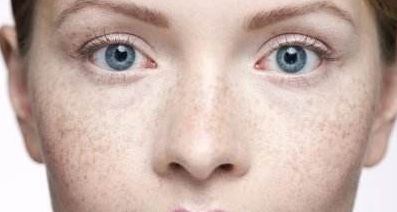 成都江濤醫(yī)生專業(yè)提供雙眼皮修復(fù)服務(wù)，助您重拾雙眼魅力