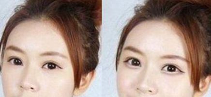 惠陽三和醫(yī)院醫(yī)療美容科項目價格表及醫(yī)院簡介解析