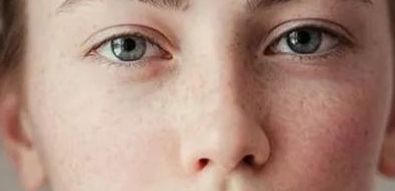 深圳鵬愛整形術(shù)后效果如何？胸部隆胸手術(shù)案例分享