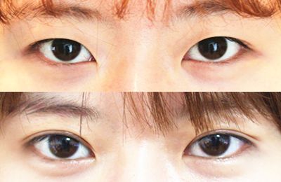 蚌埠醫(yī)學(xué)院第一附屬醫(yī)院眼科權(quán)威專家推薦！