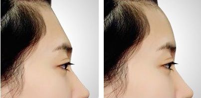 北京的八大處拉皮手術(shù)專家名單曝光！章慶國(guó)居首！