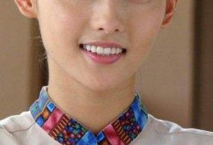 濟(jì)南芭莎美恩吳院長(zhǎng)的醫(yī)術(shù)如何？親身雙眼皮成功案例分享！