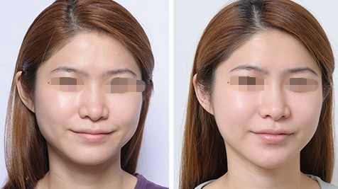 萍鄉(xiāng)地區(qū)綜合實力出眾的整容醫(yī)院盤點