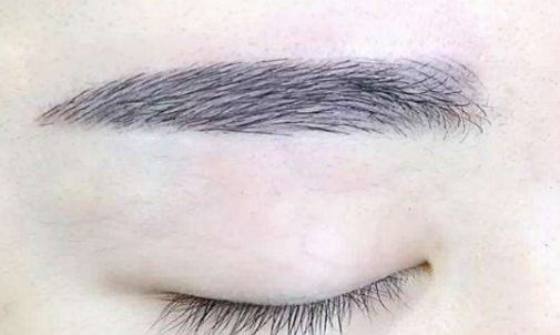 北京市優(yōu)質(zhì)微整形醫(yī)院推薦，絕對讓你滿意！