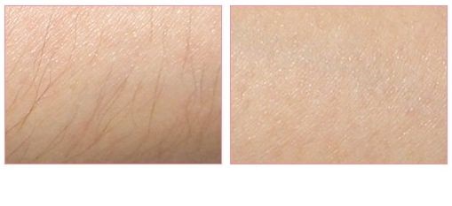 沈陽(yáng)沈河盛京尚美醫(yī)療美容門診部值得信任嗎？當(dāng)?shù)鼐用駥?duì)其口碑如何評(píng)價(jià)？