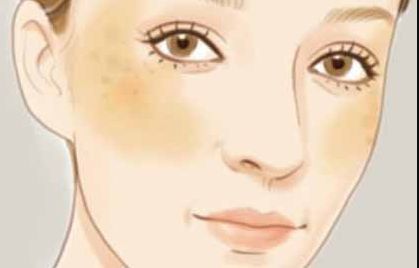 嘗試挑戰(zhàn)的你是否好奇劉珍君雙眼皮質(zhì)量如何？