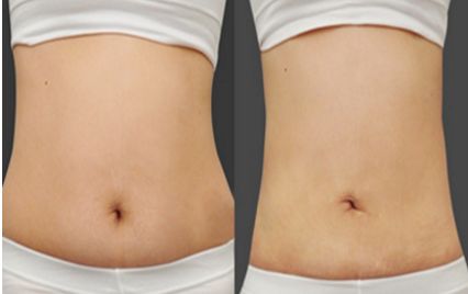 河北雙眼皮修復(fù)頂級(jí)醫(yī)院盤(pán)點(diǎn)，熱門(mén)就醫(yī)選擇一覽！