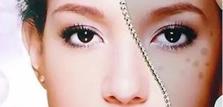 周一雄如何預(yù)約雙眼皮手術(shù)？案例分享與價(jià)格真實(shí)評(píng)估