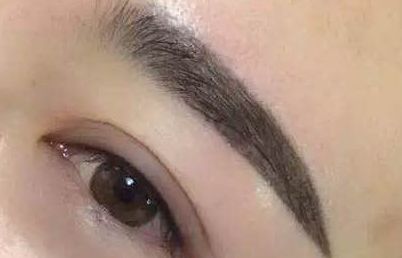 廈門鄭亞榮醫(yī)師就醫(yī)經(jīng)歷如何？患者真實(shí)案例分享及診療費(fèi)用明細(xì)更新！