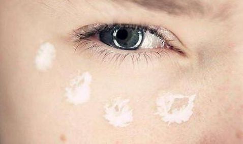 皮肉腔軟骨隆鼻手術(shù)費(fèi)用如何？鼻部整形手術(shù)安全可靠，詳細(xì)操作圖解！