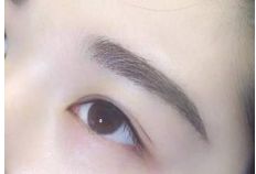 重慶銅雀臺地區(qū)雙眼皮手術(shù)頂級醫(yī)生推薦！詳細(xì)收費(fèi)一覽表