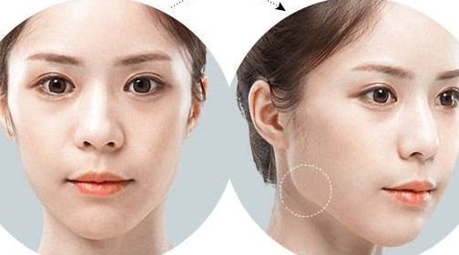 北京五家專業(yè)美容醫(yī)院熱門推薦，實(shí)力醫(yī)院排行榜快來(lái)收藏！