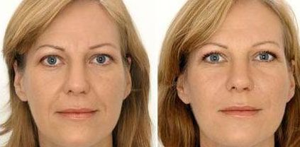 蘭州整形醫(yī)院排行榜TOP3揭曉！快來收藏吧