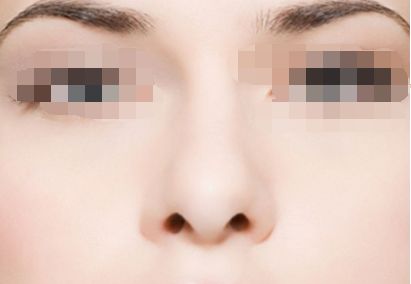 上海九院鼻部整形十強(qiáng)醫(yī)生名單公布，修復(fù)專家排名引人矚目