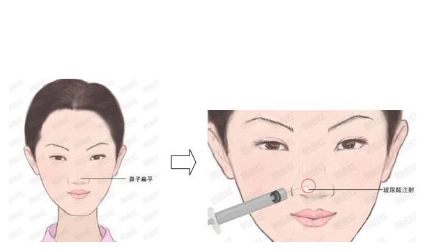 西安美容整形醫(yī)院青睞的五家除皺功效獨具匠心的佼佼者