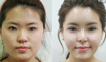 重慶頂級整形美容醫(yī)院排行榜