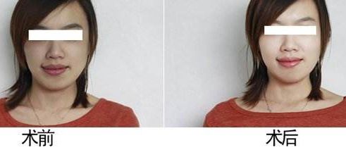 南漳縣人民醫(yī)院：二級(jí)甲等醫(yī)院，22個(gè)專業(yè)科室全面解讀